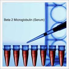 تست بتا-2 میکروگلوبولین (B2M) در تشخیص سرطان خون