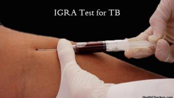 اندیکاسیون های IGRA TB Test
