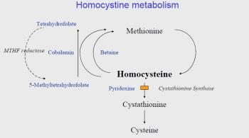 اختلالات متابولیک اسیدهای آمینه - بیماری هموسیستینوری