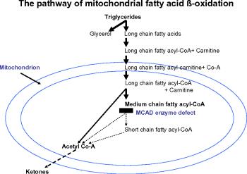 اختلالات متابولیک اسیدهای چرب- MCADD 