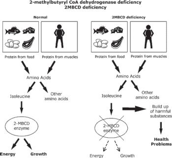 اختلالات متابولیک اسید های اُرگانیک: 2methylbutyryl CoA dehydrogenase deficiency