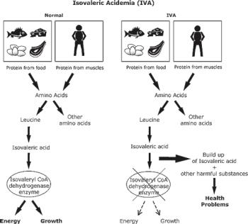 اختلالات متابولیک اسیدهای اُرگانیک: Isovaleric Acidemia