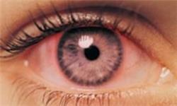 بیماران مبتلا به تیروئید مراقب چشمانتان باشید